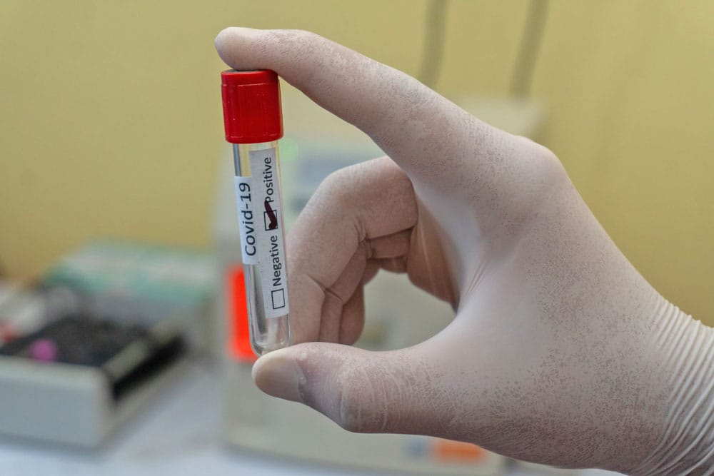 Delta variant a ‘big problem’ in WDGPH region: Tenenbaum post image