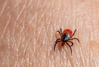 It's tick season and their numbers are on the rise post image