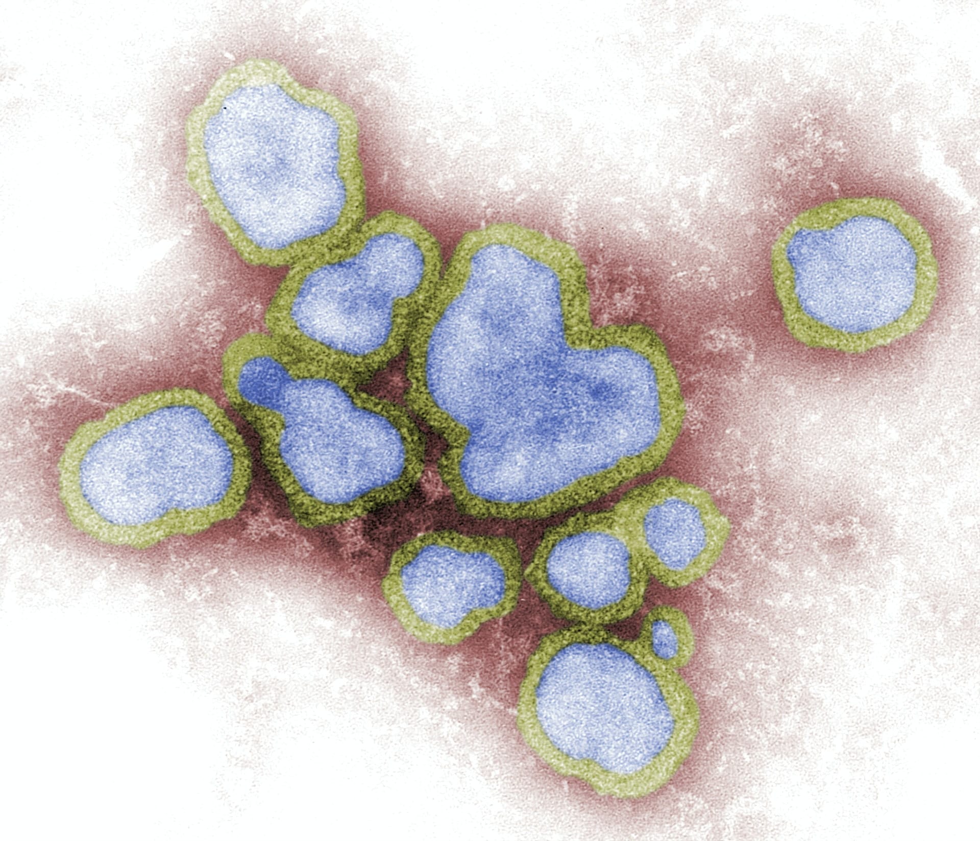 Public health confirms first lab-confirmed case of influenza in over a year