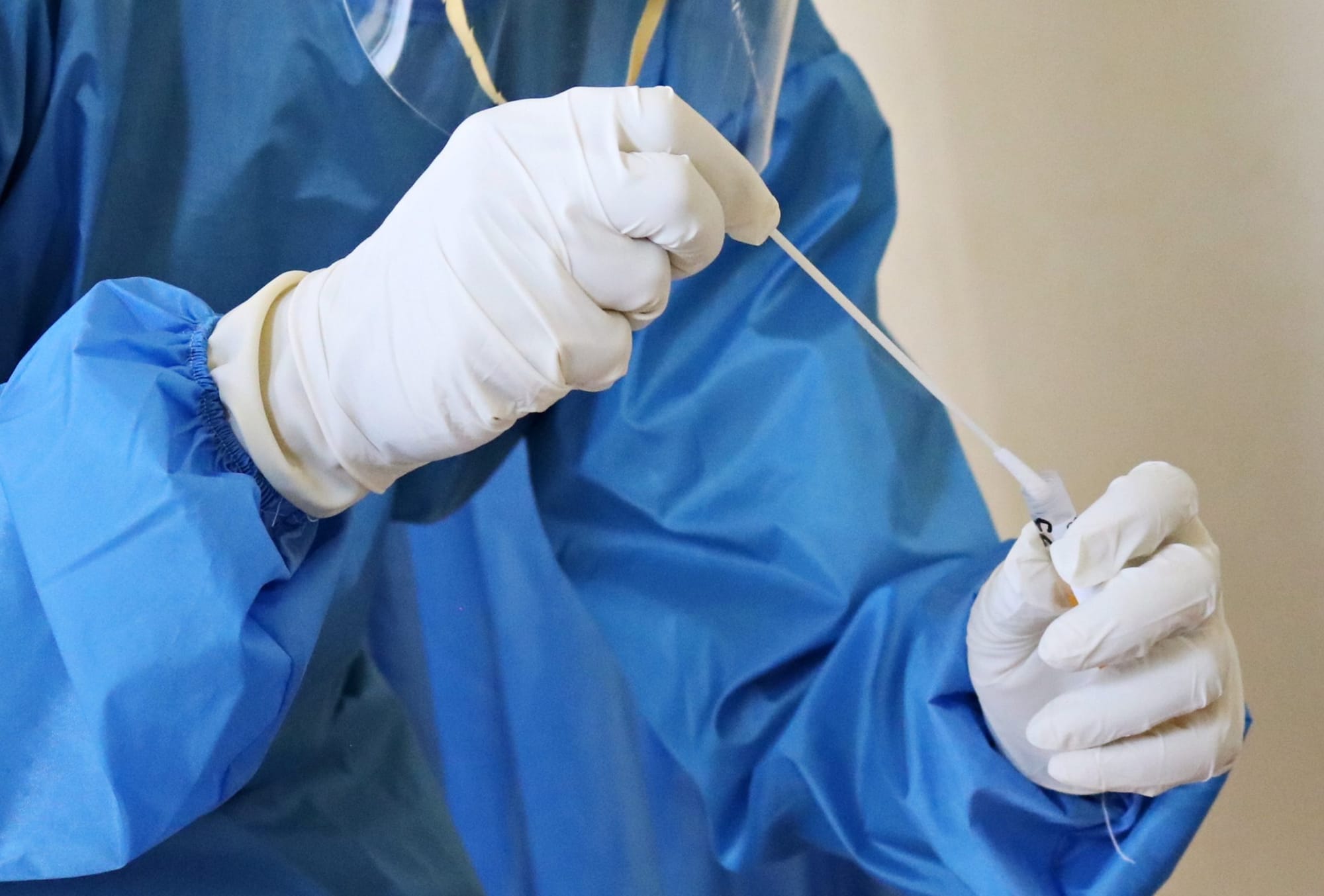 WDGPH confirms first case of COVID-19 Omicron variant in Guelph